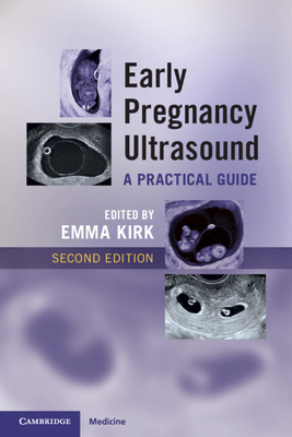 Early Pregnancy Ultrasound: A Practical Guide 1009519026 Book Cover