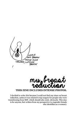 My Breast Reduction 1621062961 Book Cover