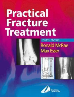 Practical Fracture Treatment, 4th Edition 0443070385 Book Cover