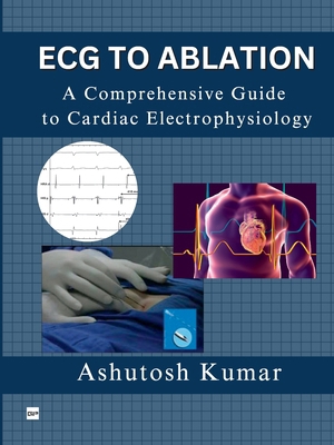 ECG to Ablation: A Comprehensive Guide to Cardi... 8119170377 Book Cover
