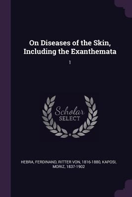 On Diseases of the Skin, Including the Exanthem... 1378115449 Book Cover