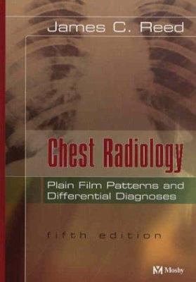 Chest Radiology: Plain Film Patterns and Differ... 0323026176 Book Cover