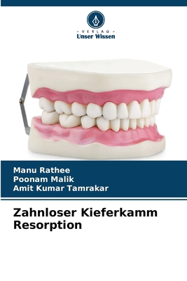 Zahnloser Kieferkamm Resorption [German] 6209221866 Book Cover