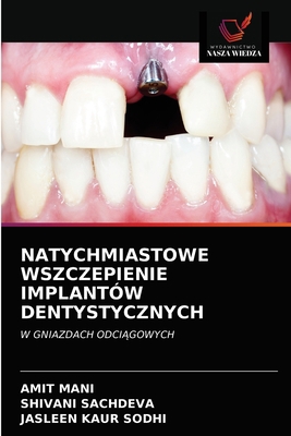 Natychmiastowe Wszczepienie Implantów Dentystyc... [Polish] 620321650X Book Cover