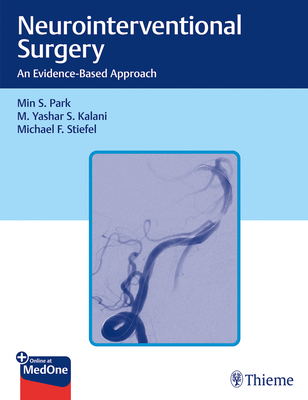 Neurointerventional Surgery: An Evidence-Based ... 1684200075 Book Cover