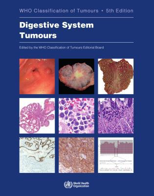 Digestive System Tumours: Who Classification of... 9283244990 Book Cover