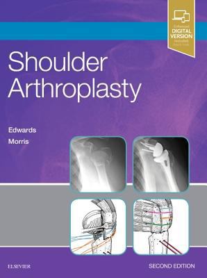 Shoulder Arthroplasty 0323529402 Book Cover