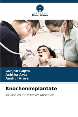 Knochenimplantate [German] 6208799732 Book Cover