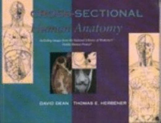 Cross-sectional Human Anatomy: Human Anatomy 0781726743 Book Cover