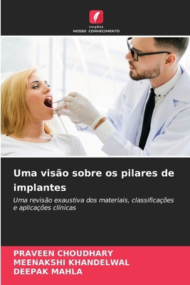 Uma visão sobre os pilares de implantes [Portuguese] 6132681094 Book Cover