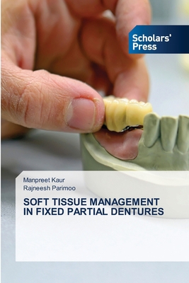 Soft Tissue Management in Fixed Partial Dentures 6138951719 Book Cover