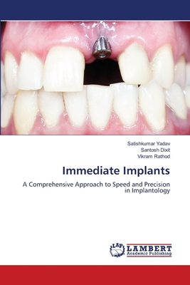 Immediate Implants 6207995503 Book Cover