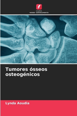 Tumores ósseos osteogénicos [Portuguese] 6207224663 Book Cover