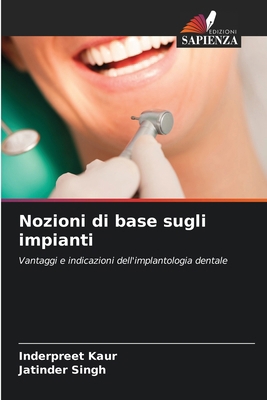 Nozioni di base sugli impianti [Italian] 6202209364 Book Cover