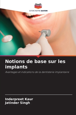 Notions de base sur les implants [French] 6202209321 Book Cover