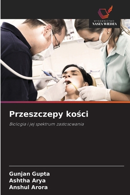 Przeszczepy ko&#347;ci [Polish] 6208799775 Book Cover