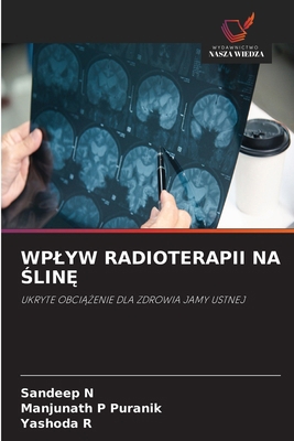 Wplyw Radioterapii Na ŚlinĘ [Polish] 6630356489 Book Cover