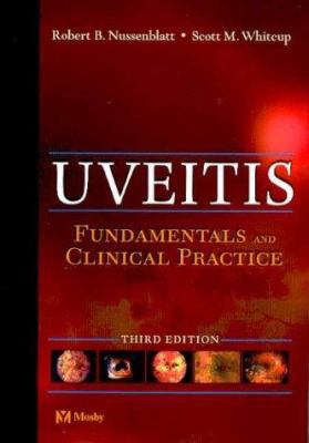 Uveitis: Fundamentals and Clinical Practice 0323022375 Book Cover