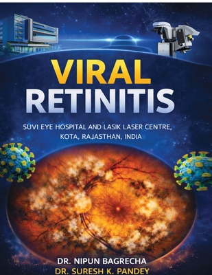 Viral Retinitis B0GQ95YP9C Book Cover