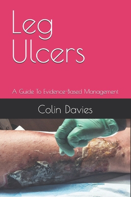 Leg Ulcers: A Guide To Evidence-Based Management B0FW8GYRCV Book Cover