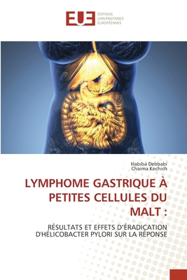 Lymphome Gastrique À Petites Cellules Du Malt [French] 6206726029 Book Cover