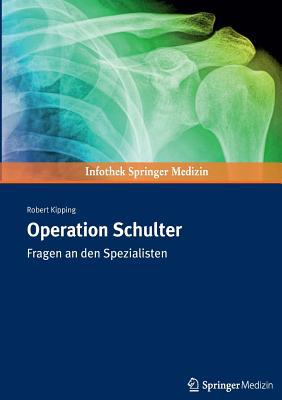 Operation Schulter: Fragen an Den Spezialisten [German] 3899352998 Book Cover