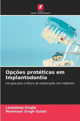 Opções protéticas em Implantodontia [Portuguese] 6208168775 Book Cover