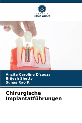 Chirurgische Implantatführungen [German] 6208075599 Book Cover