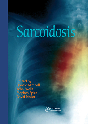 Sarcoidosis 0367576767 Book Cover