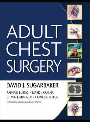 Adult Chest Surgery B01ADO4NE6 Book Cover