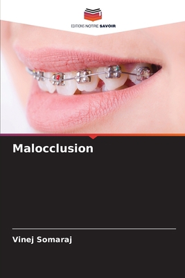 Malocclusion [French] 6205626535 Book Cover