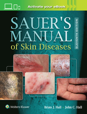 Sauer's Manual of Skin Diseases 1496329937 Book Cover
