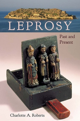Leprosy: Past and Present 1683401840 Book Cover