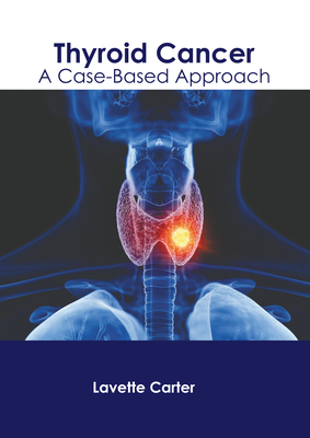 Thyroid Cancer: A Case-Based Approach B0CFXLN7HZ Book Cover