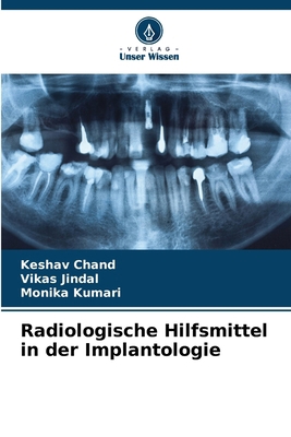 Radiologische Hilfsmittel in der Implantologie [German] 620861810X Book Cover
