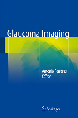 Glaucoma Imaging 3319189581 Book Cover
