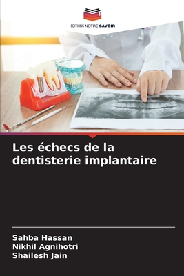 Les échecs de la dentisterie implantaire [French] 620828600X Book Cover