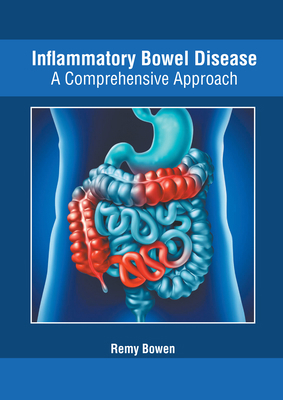 Inflammatory Bowel Disease: A Comprehensive App... 1632429608 Book Cover