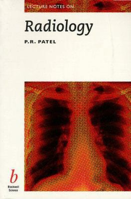 Lecture Notes on Radiology [Large Print] 0632047585 Book Cover