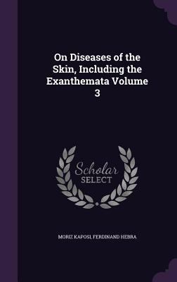 On Diseases of the Skin, Including the Exanthem... 1359218912 Book Cover