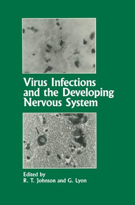 Virus Infections and the Developing Nervous System 0746200536 Book Cover