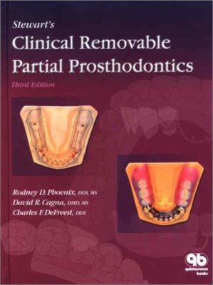 Stewart's Clinical Removable Partial Prosthodon... 0867154179 Book Cover