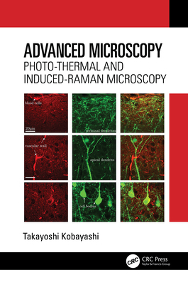 Advanced Microscopy: Photo-Thermal and Induced-... 1032758856 Book Cover