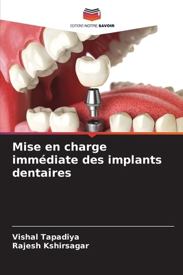 Mise en charge immédiate des implants dentaires [French] 6207660773 Book Cover