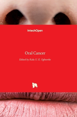 Oral Cancer 9535102281 Book Cover