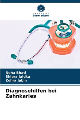 Diagnosehilfen bei Zahnkaries [German] 6207064038 Book Cover