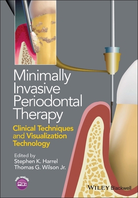 Minimally Invasive Periodontal Therapy: Clinica... 1118607627 Book Cover