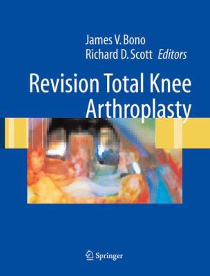 Revision Total Knee Arthroplasty B01CMYAAM4 Book Cover