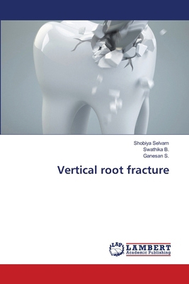 Vertical root fracture 6206740285 Book Cover