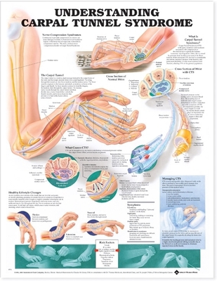 Understanding Carpal Tunnel Syndrome Anatomical... 1587793210 Book Cover